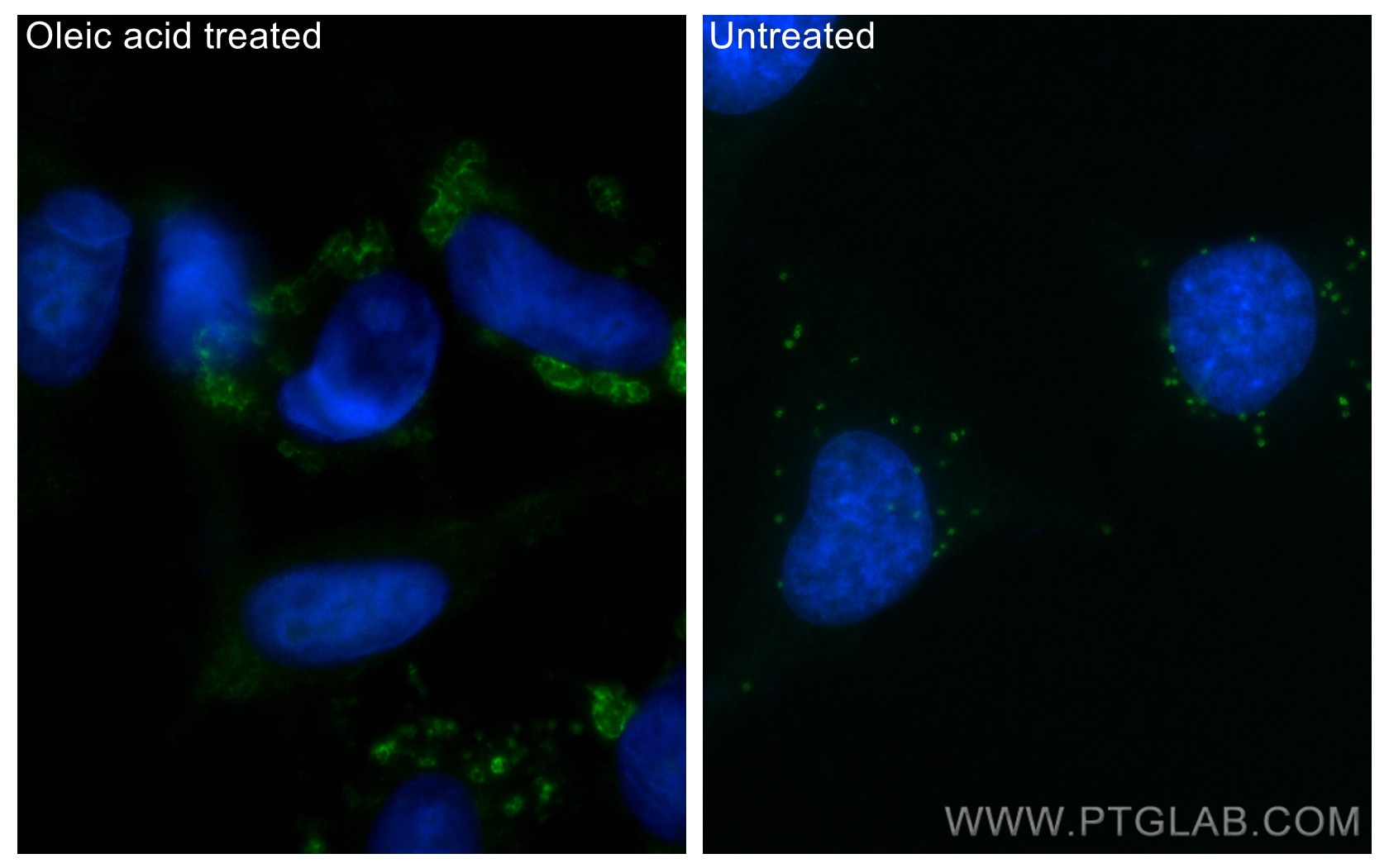 Immunofluorescence (IF) / fluorescent staining of HeLa cells using CoraLite® Plus 488-conjugated ADRP/Perilipin 2 Pol (CL488-15294)