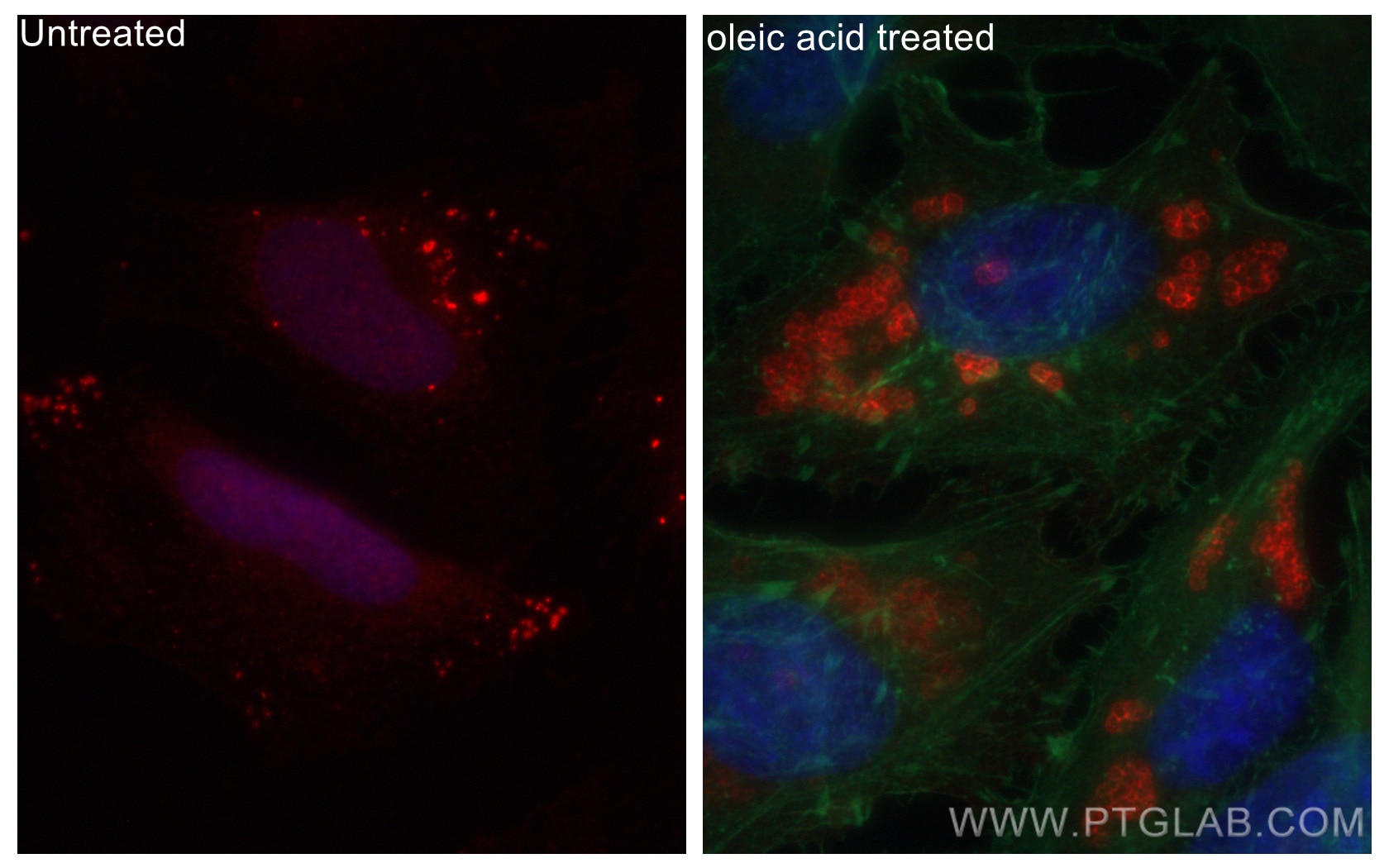 Immunofluorescence (IF) / fluorescent staining of HeLa cells using CoraLite®594-conjugated ADRP/Perilipin 2 Polyclona (CL594-15294)