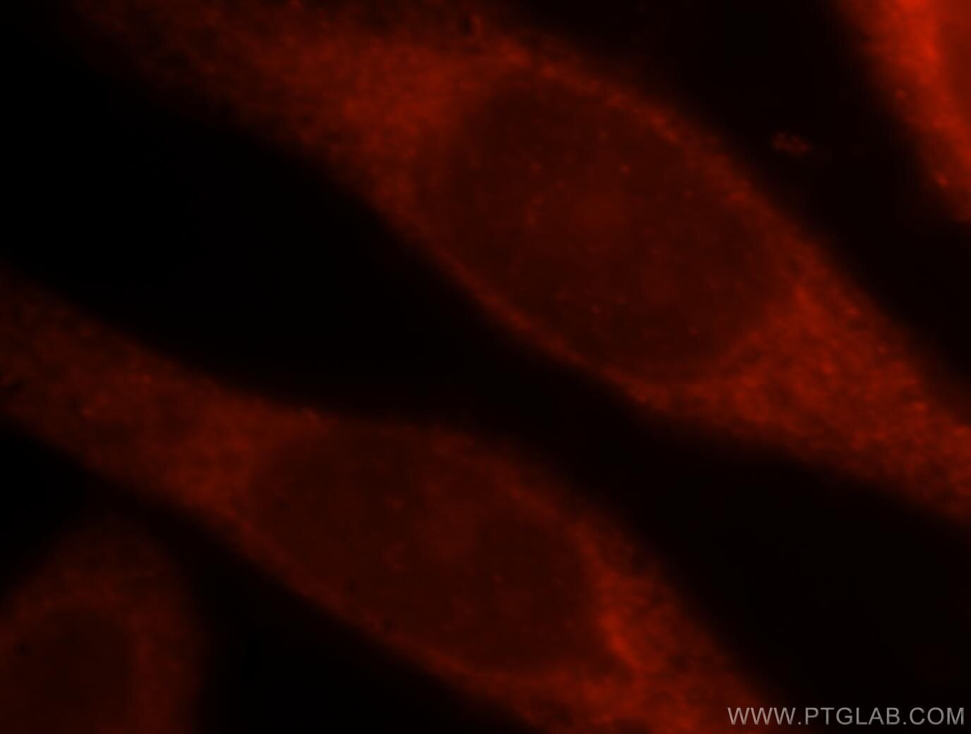 Immunofluorescence (IF) / fluorescent staining of HeLa cells using Adenylosuccinate lyase Polyclonal antibody (15264-1-AP)