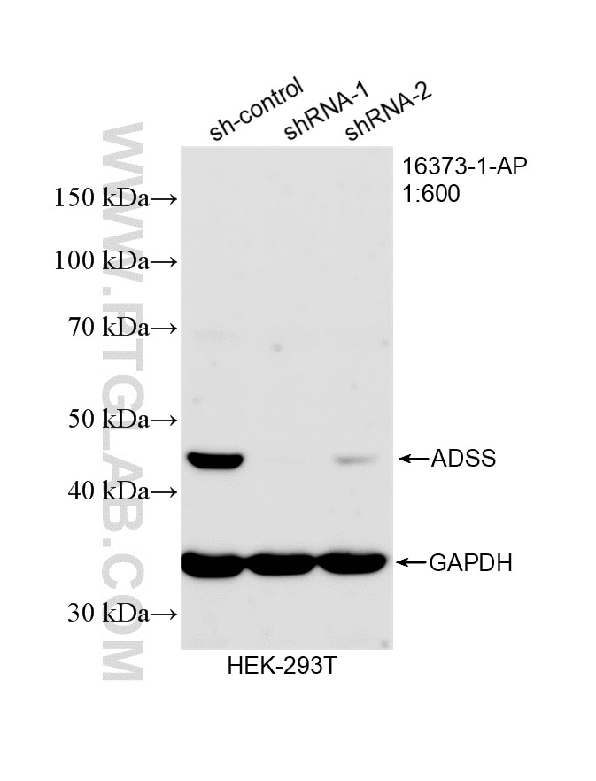 Western Blot (WB) analysis of HEK-293 cells using ADSS1/2 Polyclonal antibody (16373-1-AP)