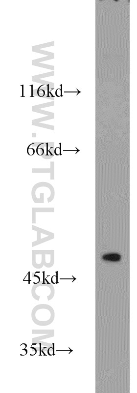 Western Blot (WB) analysis of mouse skeletal muscle tissue using ADSS Polyclonal antibody (16373-1-AP)