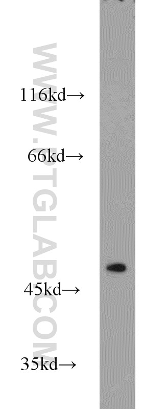 ADSS Polyclonal antibody