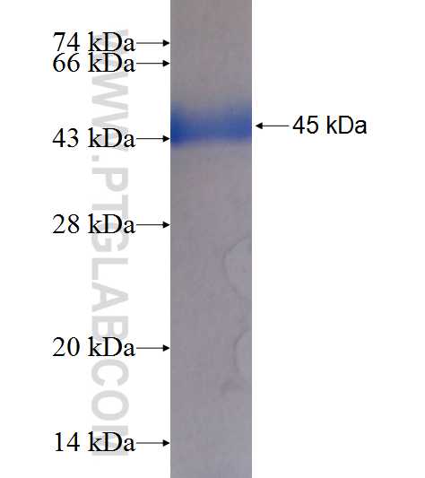 ADSS fusion protein Ag9323 SDS-PAGE