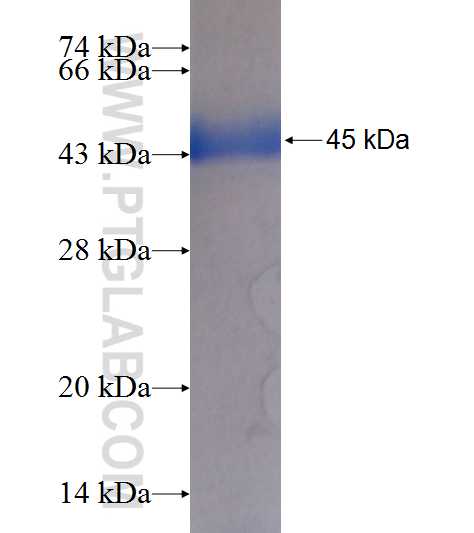 ADSS fusion protein Ag9323 SDS-PAGE