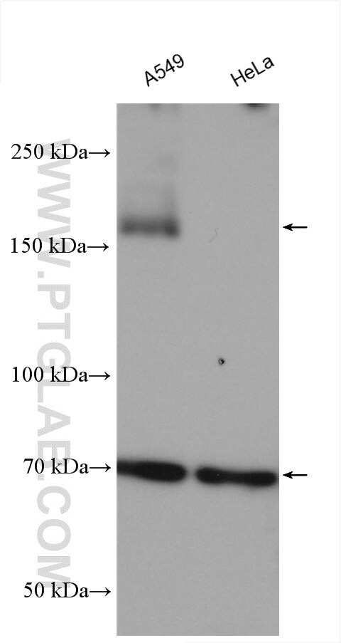 Western Blot (WB) analysis of various lysates using AE2 Polyclonal antibody (26332-1-AP)