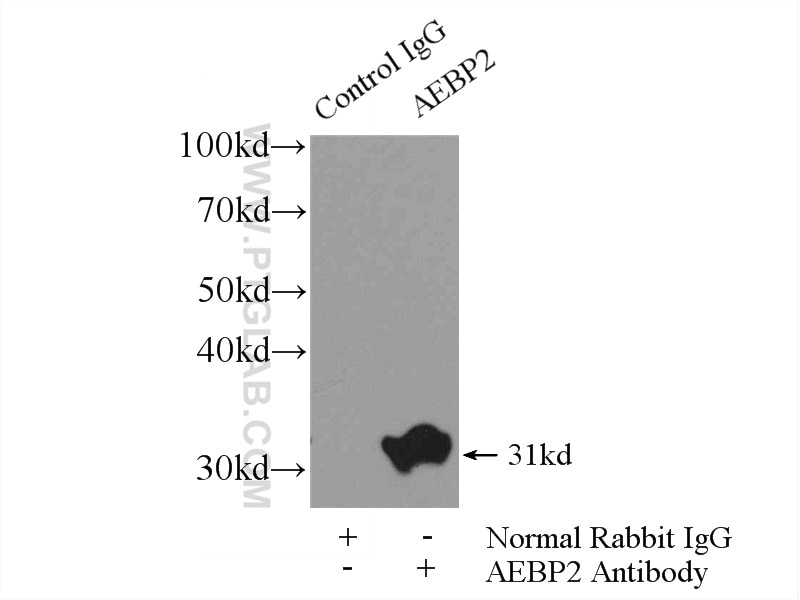 Immunoprecipitation (IP) experiment of mouse testis tissue using AEBP2 Polyclonal antibody (11232-2-AP)