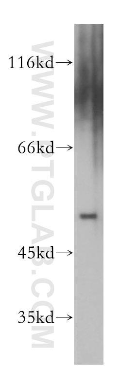 Western Blot (WB) analysis of human testis tissue using AEBP2 Polyclonal antibody (11232-2-AP)