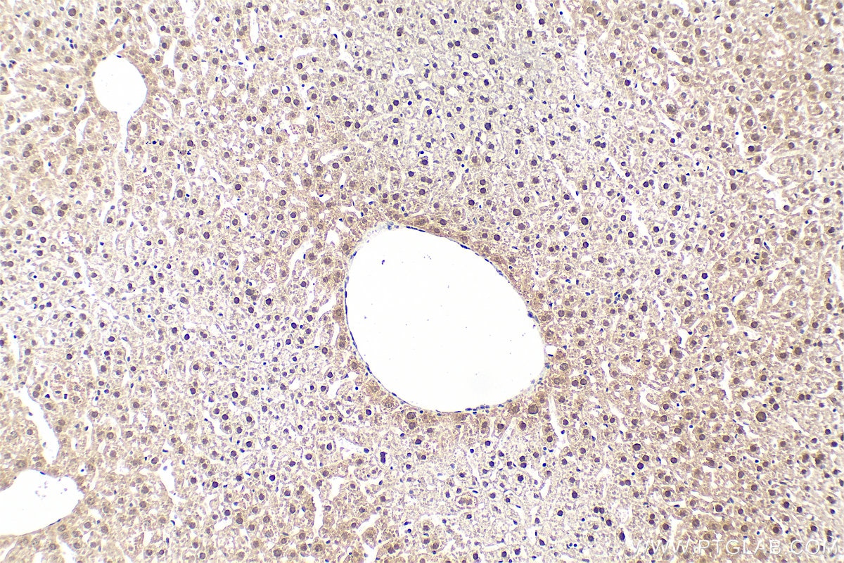 IHC staining of mouse liver using 66141-1-Ig Immunohistochemistry (IHC) staining of mouse liver tissue using AEBP2 Monoclonal antibody (66141-1-Ig)