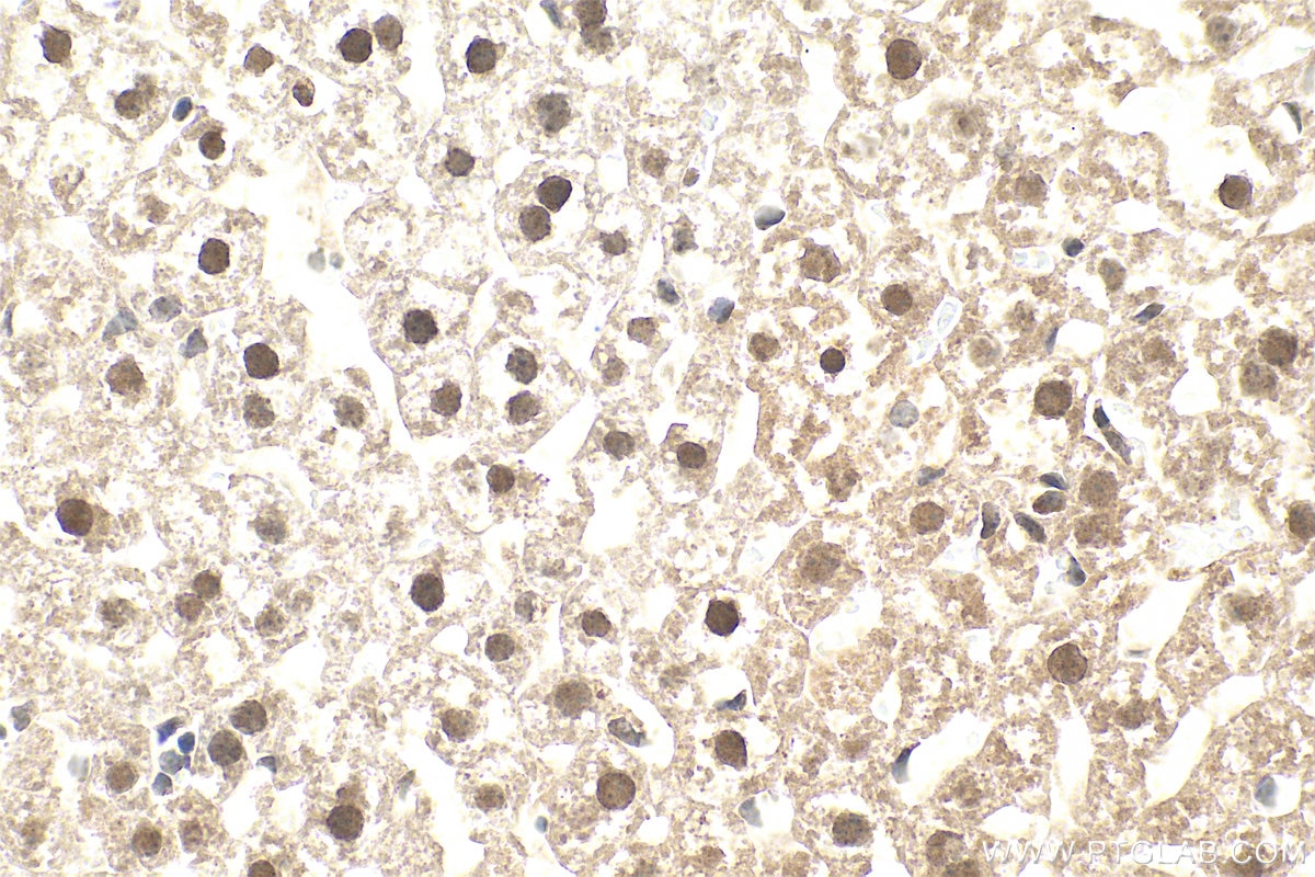 IHC staining of mouse liver using 66141-1-Ig Immunohistochemistry (IHC) staining of mouse liver tissue using AEBP2 Monoclonal antibody (66141-1-Ig)