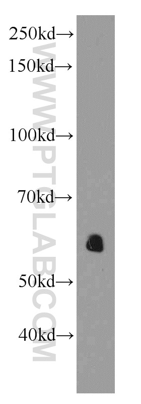 Western Blot (WB) analysis of HeLa cells using AEBP2 Monoclonal antibody (66141-1-Ig)