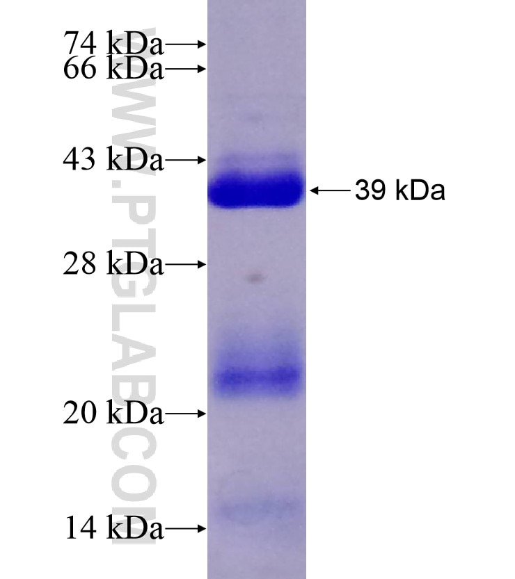 AEBP2 fusion protein Ag17905 SDS-PAGE