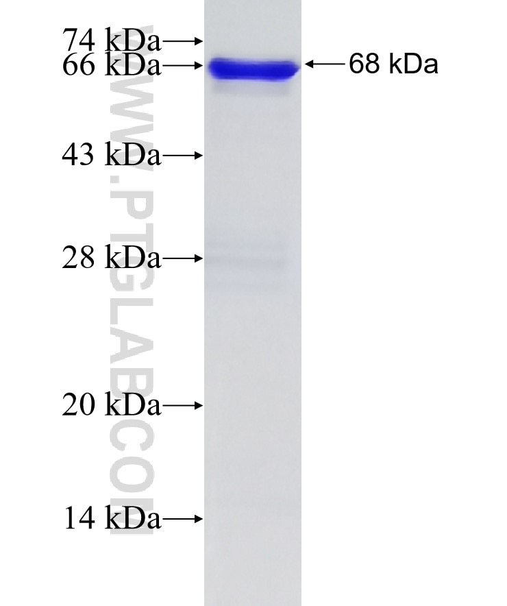 AEG-1 fusion protein Ag4840 SDS-PAGE