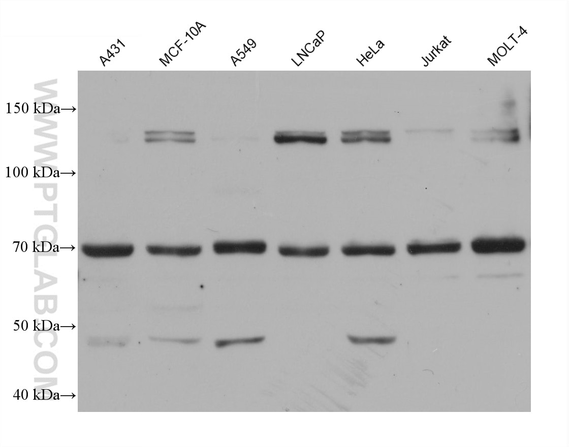 Western Blot (WB) analysis of various lysates using AEG-1/MTDH Monoclonal antibody (68592-1-Ig)