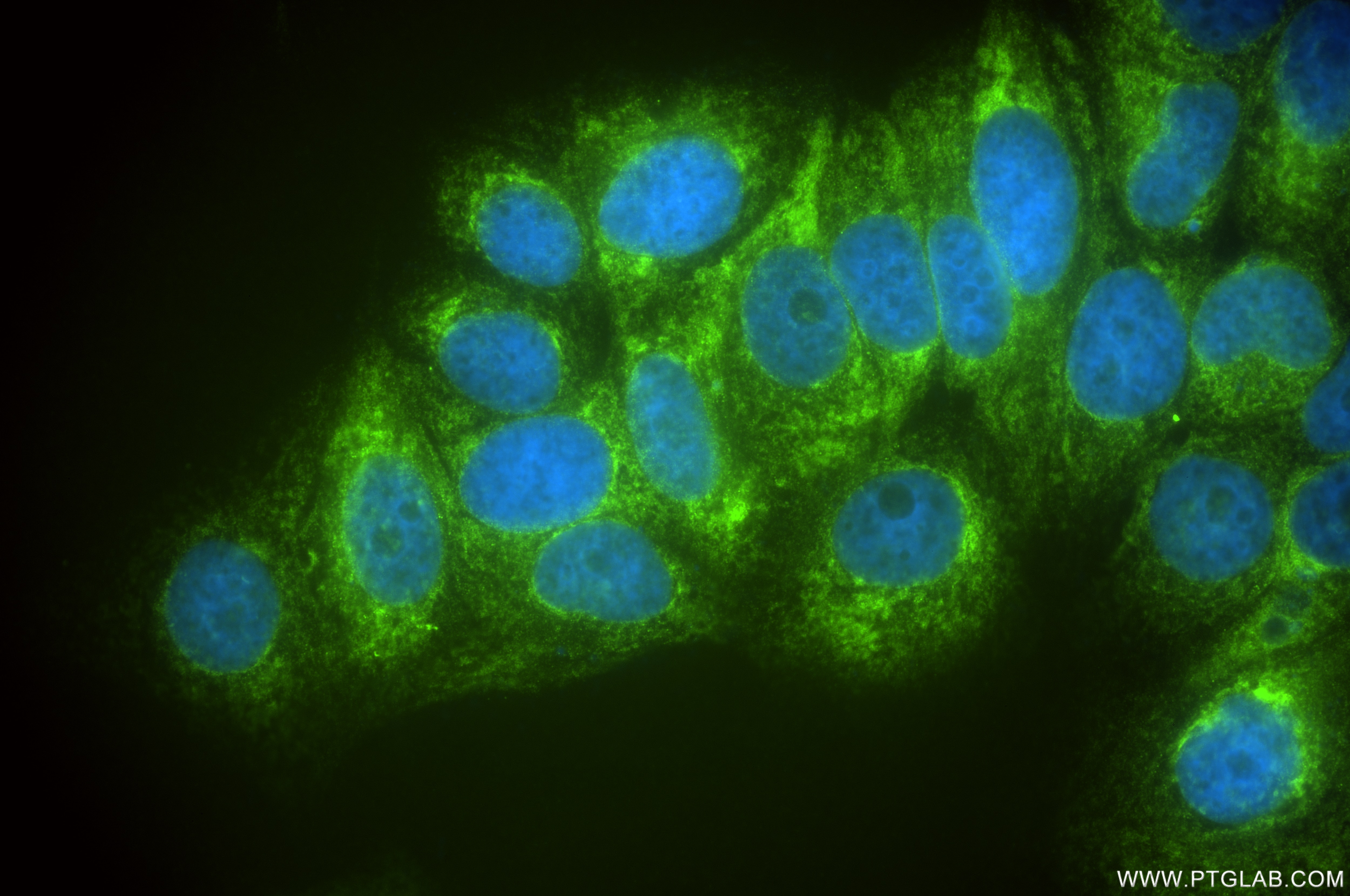 Immunofluorescence (IF) / fluorescent staining of MCF-7 cells using AEG-1/MTDH Recombinant antibody (84686-4-RR)