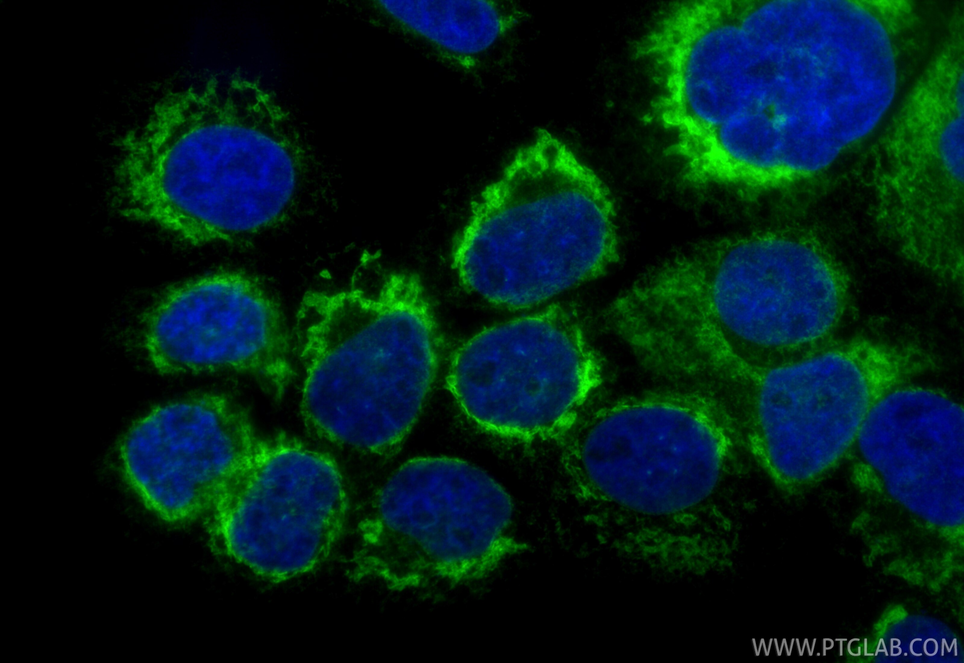 Immunofluorescence (IF) / fluorescent staining of A431 cells using AEG-1/MTDH Recombinant antibody (84686-4-RR)