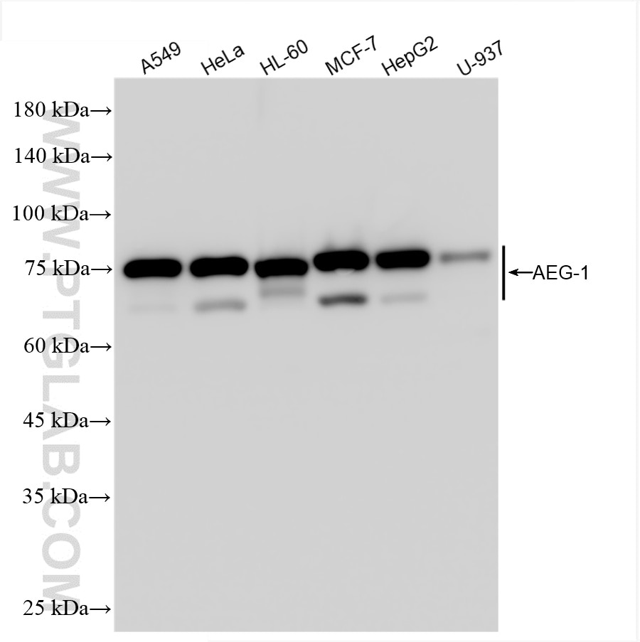 Western Blot (WB) analysis of various lysates using AEG-1/MTDH Recombinant antibody (84686-4-RR)