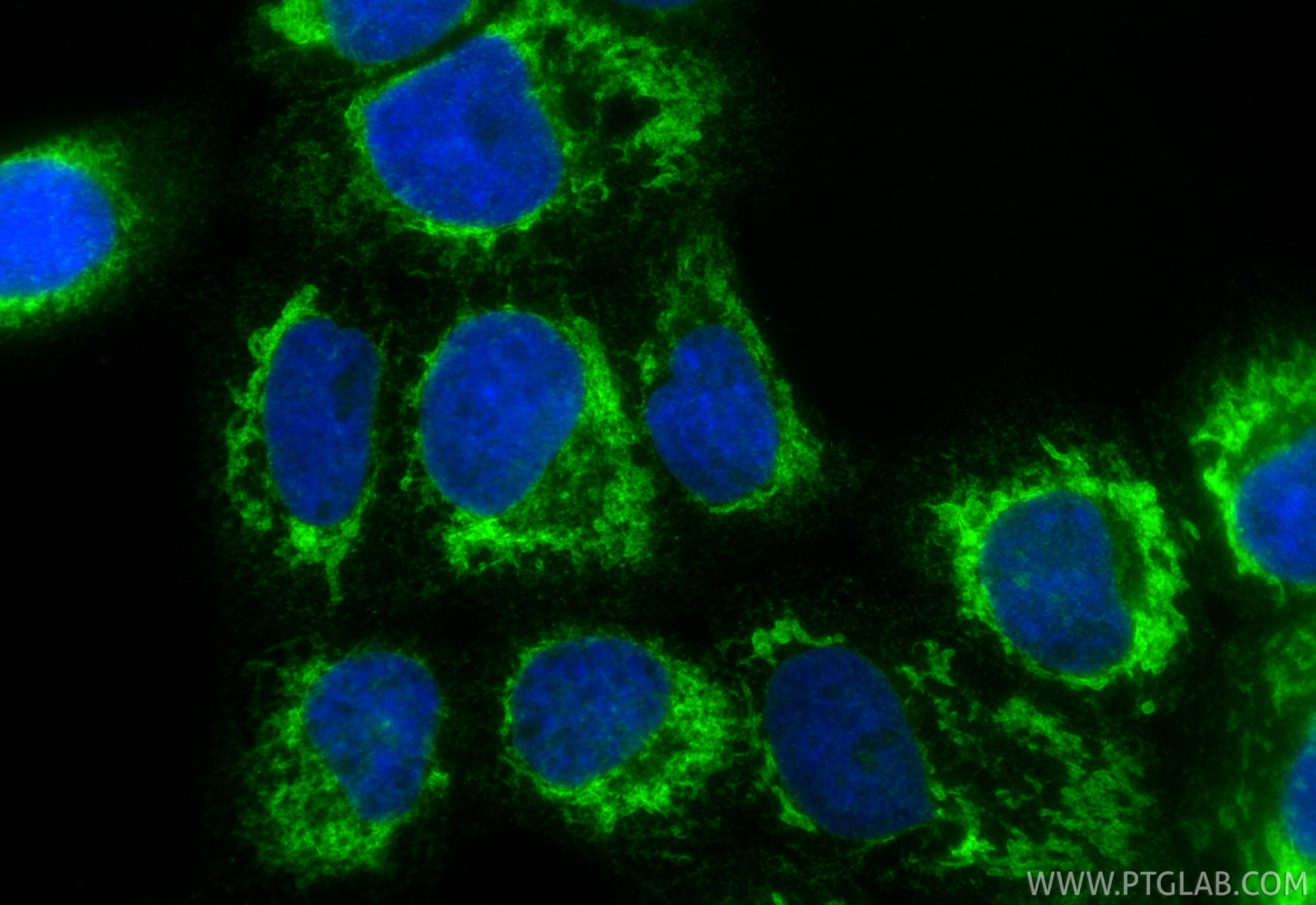 Immunofluorescence (IF) / fluorescent staining of A431 cells using CoraLite® Plus 488-conjugated AEG-1/MTDH Recombina (CL488-84686-4)