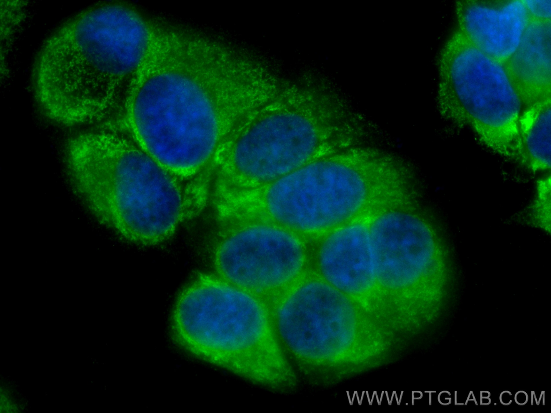 Immunofluorescence (IF) / fluorescent staining of MCF-7 cells using CoraLite® Plus 488-conjugated AEG-1/MTDH-Specific  (CL488-13860)