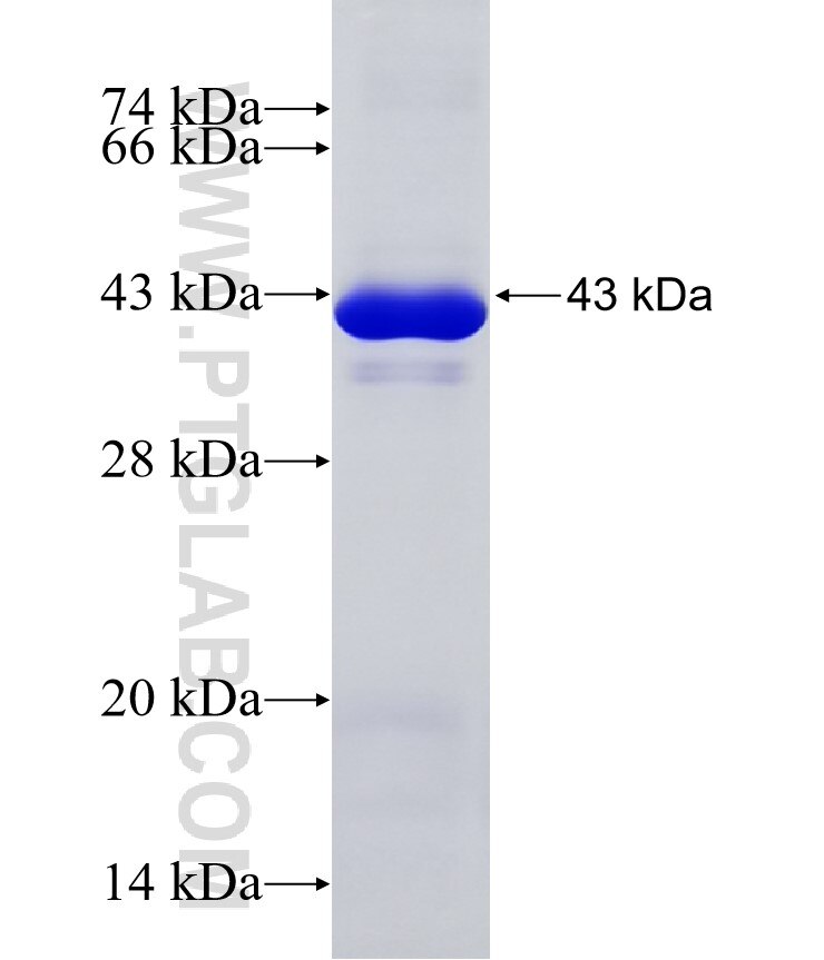 AEN fusion protein Ag34575 SDS-PAGE