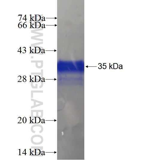 AES fusion protein Ag21021 SDS-PAGE