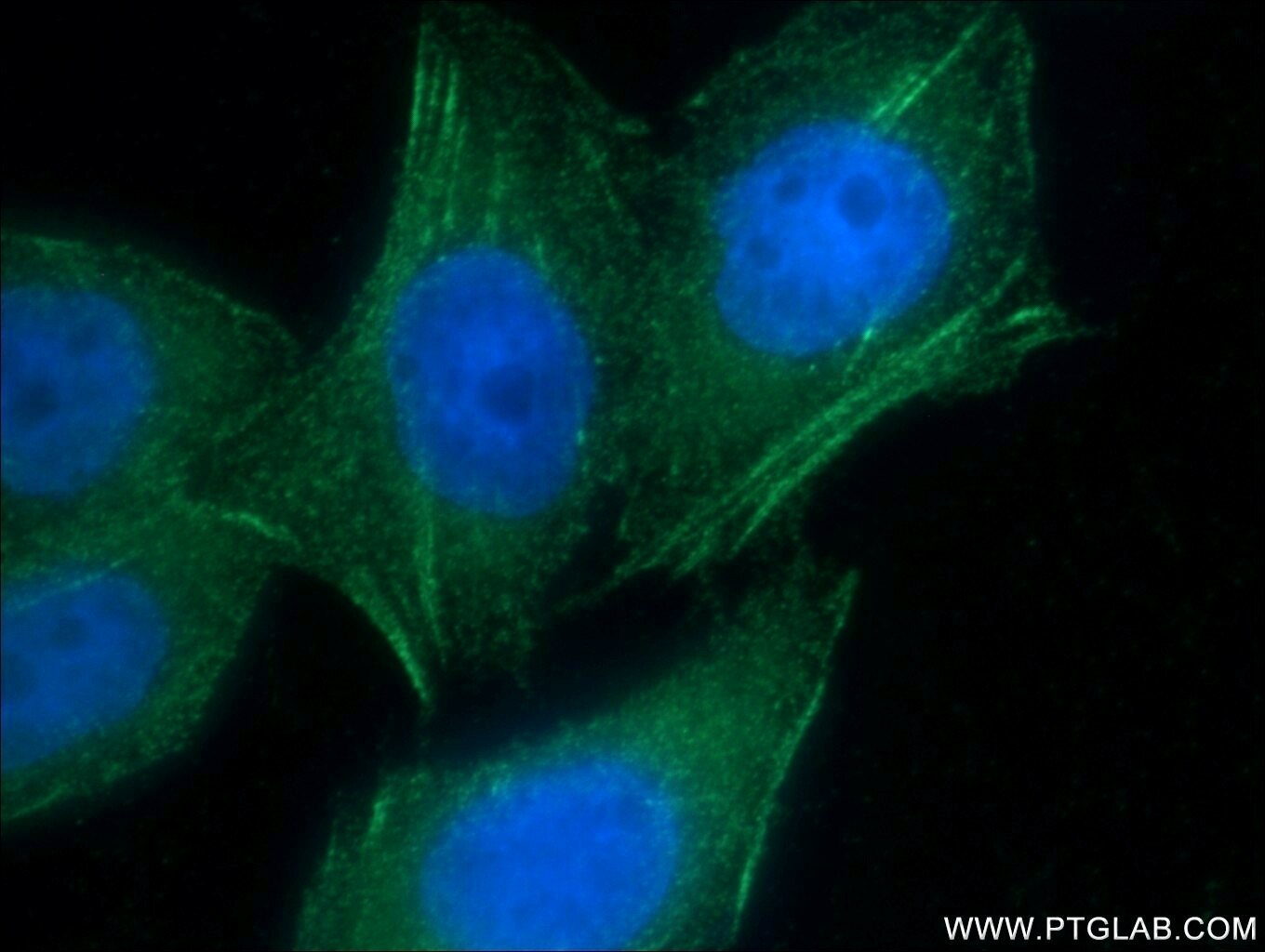Immunofluorescence (IF) / fluorescent staining of MCF-7 cells using AFAP1 Polyclonal antibody (21093-1-AP)