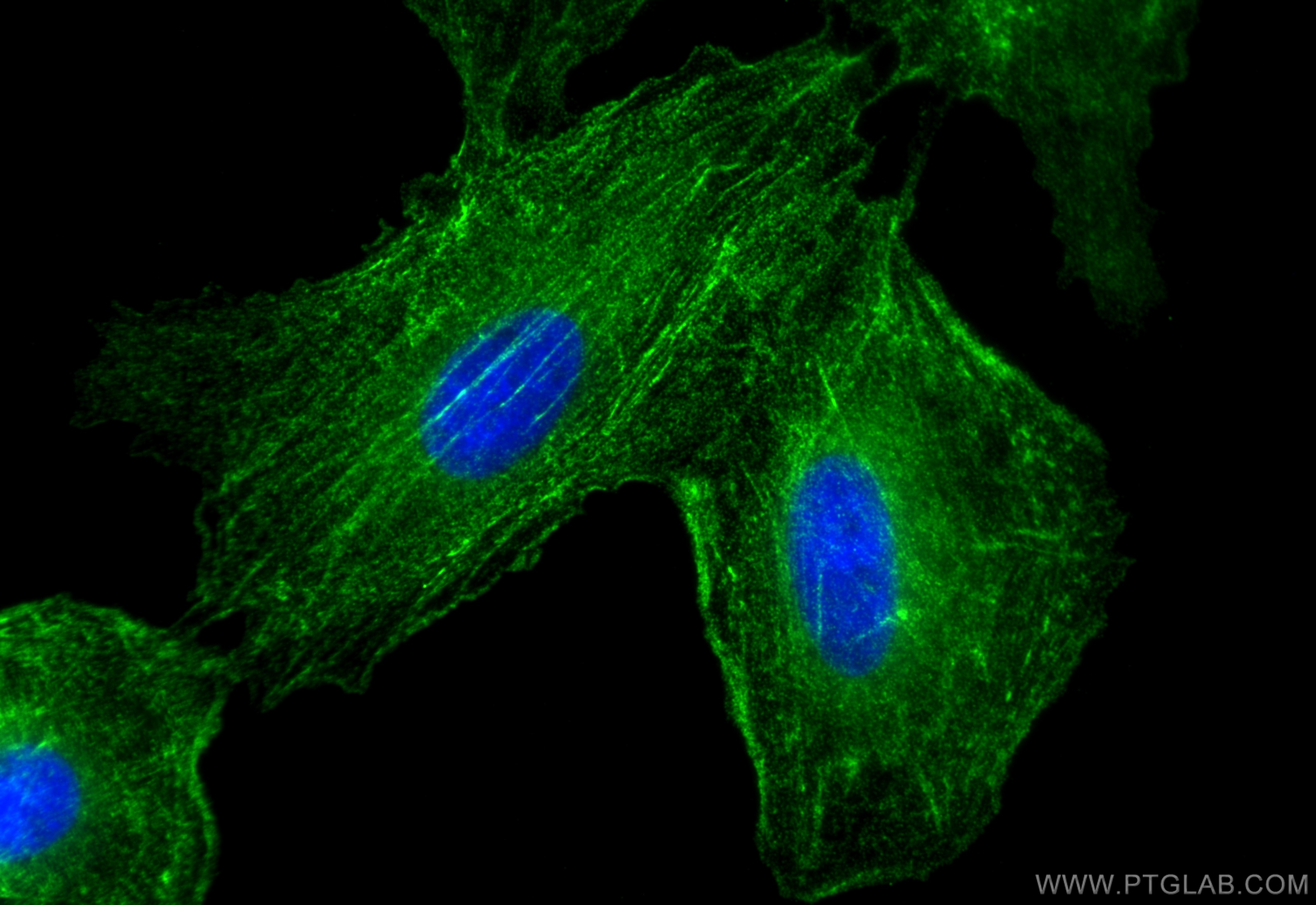 Immunofluorescence (IF) / fluorescent staining of A549 cells using AFAP1 Polyclonal antibody (21093-1-AP)