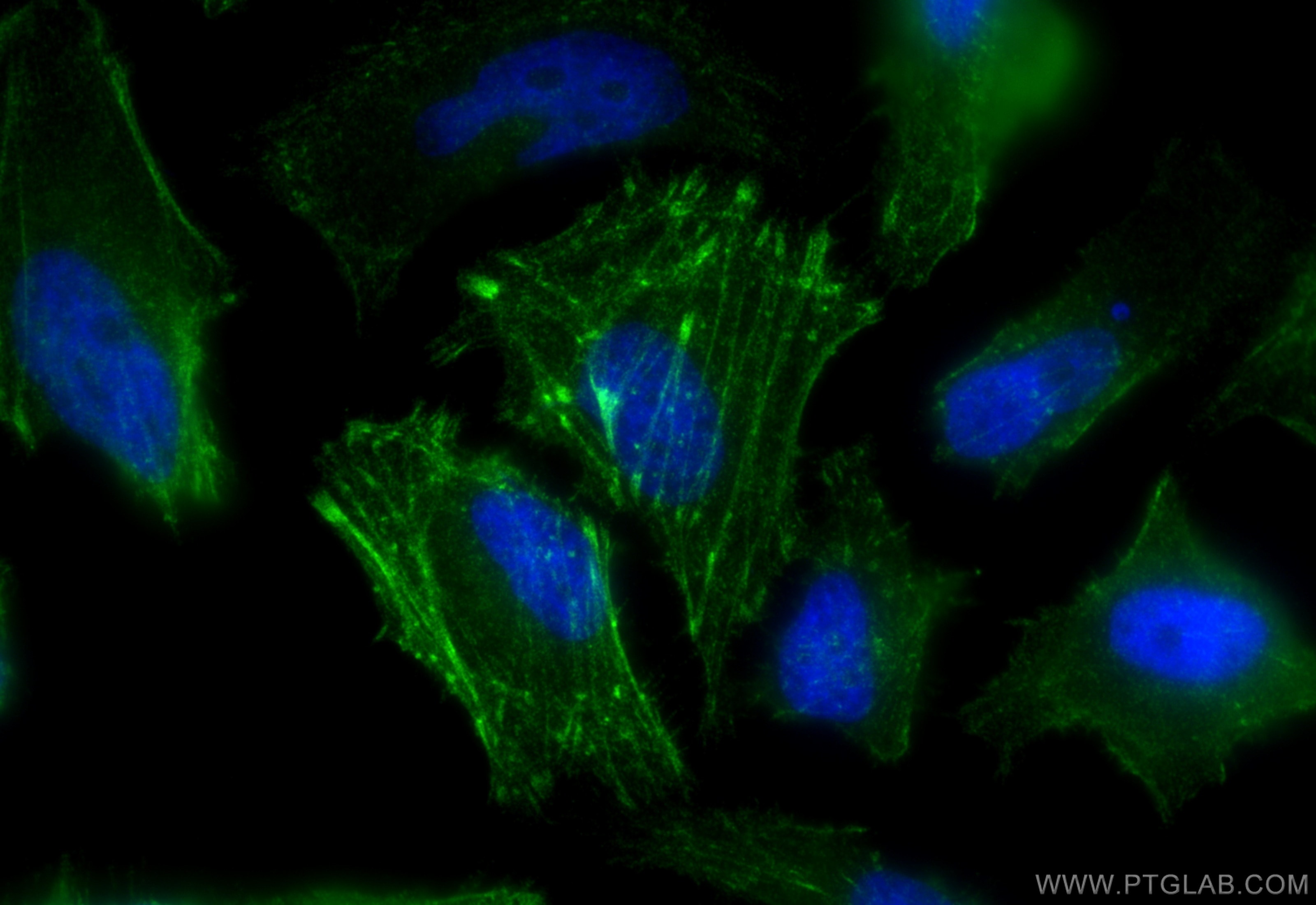 Immunofluorescence (IF) / fluorescent staining of HeLa cells using AFAP1 Polyclonal antibody (21093-1-AP)