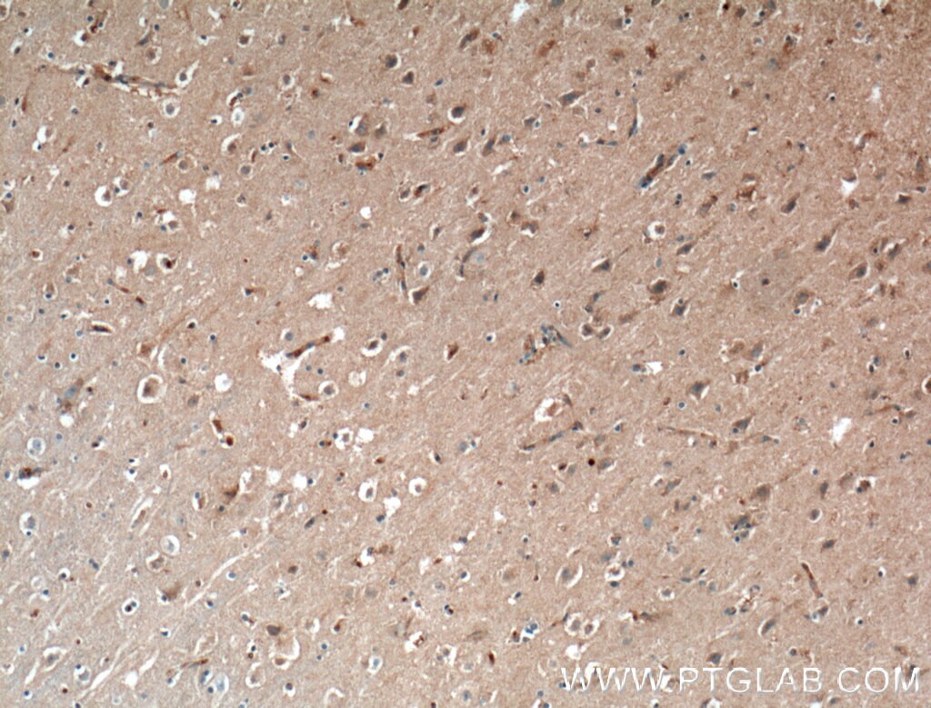 Immunohistochemistry (IHC) staining of human brain tissue using AFAP1 Polyclonal antibody (21093-1-AP)