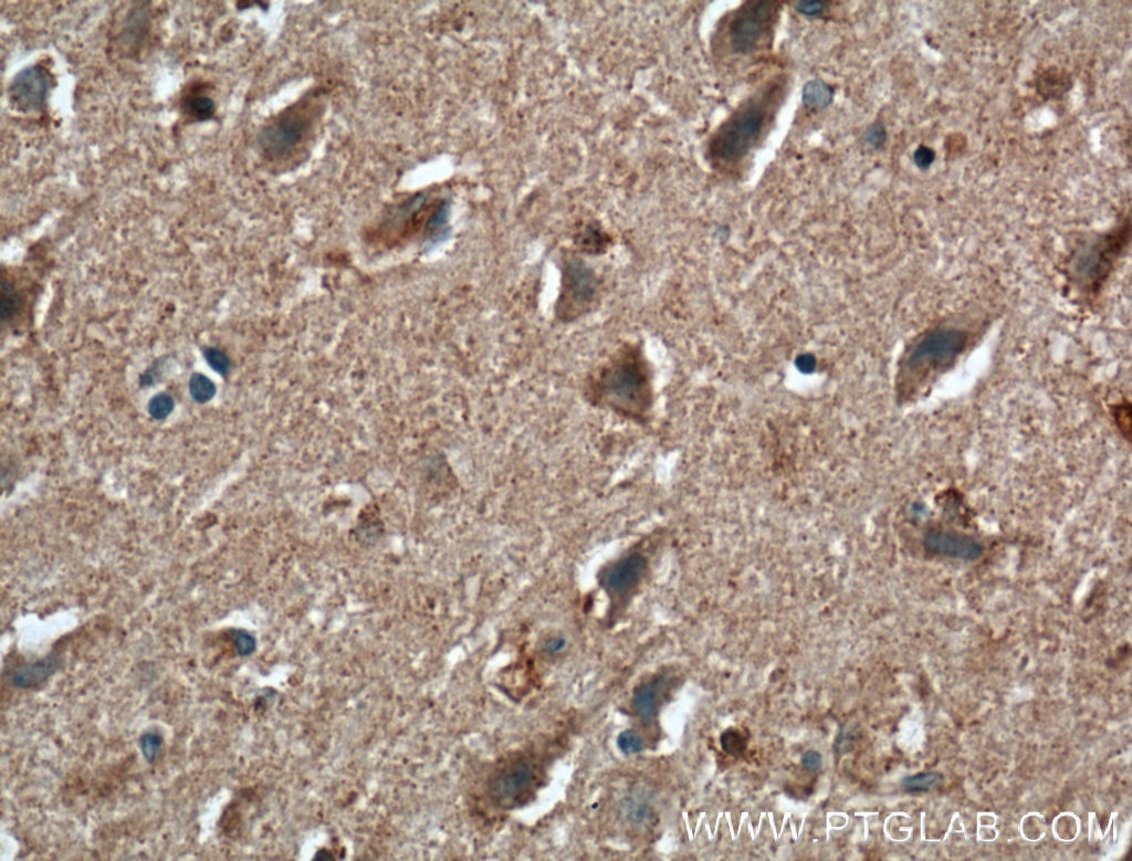 Immunohistochemistry (IHC) staining of human brain tissue using AFAP1 Polyclonal antibody (21093-1-AP)