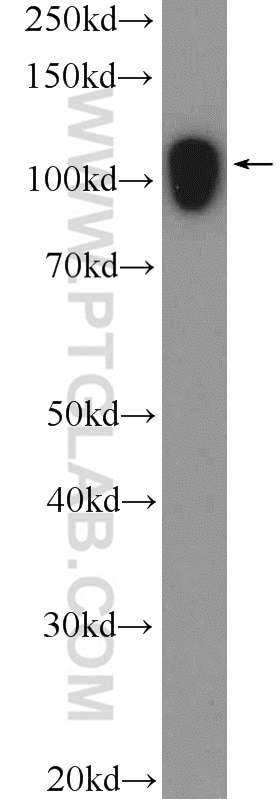 Western Blot (WB) analysis of rat brain tissue using AFAP1 Polyclonal antibody (21093-1-AP)