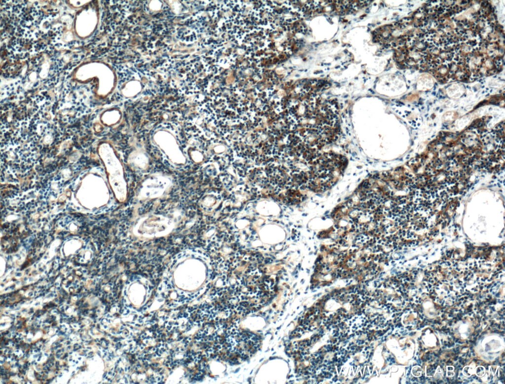 Immunohistochemistry (IHC) staining of human thymus tissue using AFAP1L2 Polyclonal antibody (17183-1-AP)