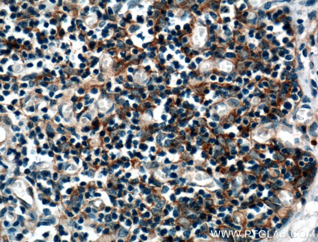 Immunohistochemistry (IHC) staining of human thymus tissue using AFAP1L2 Polyclonal antibody (17183-1-AP)