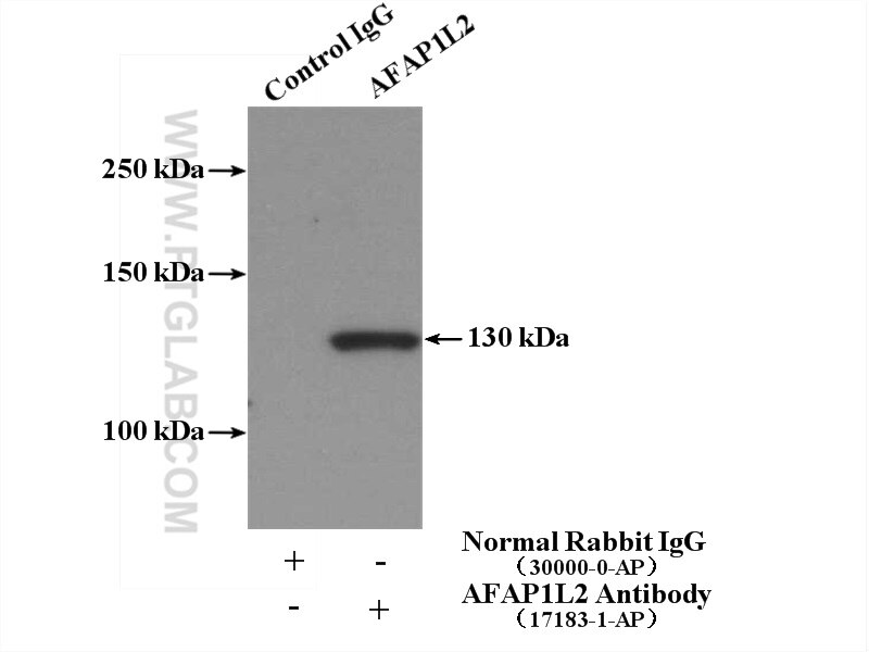 Immunoprecipitation (IP) experiment of mouse thymus tissue using AFAP1L2 Polyclonal antibody (17183-1-AP)