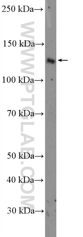 Western Blot (WB) analysis of mouse thymus tissue using AFAP1L2 Polyclonal antibody (17183-1-AP)