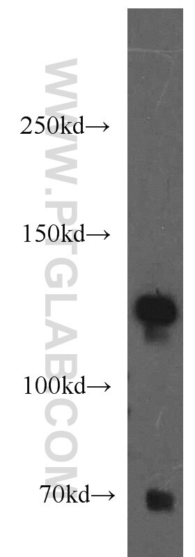 Western Blot (WB) analysis of mouse thymus tissue using AFAP1L2 Polyclonal antibody (17183-1-AP)