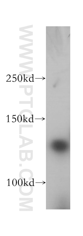 Western Blot (WB) analysis of mouse thymus tissue using AFAP1L2 Polyclonal antibody (17183-1-AP)