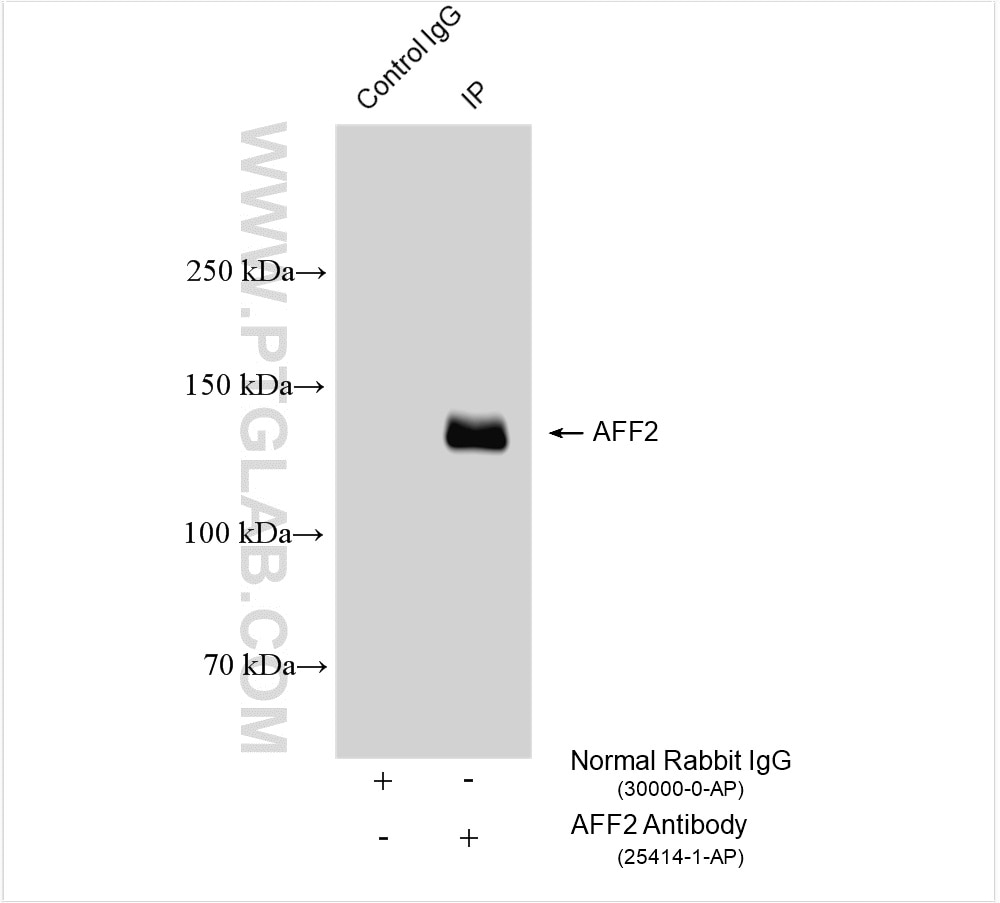 Immunoprecipitation (IP) experiment of SH-SY5Y cells using AFF2 Polyclonal antibody (25414-1-AP)