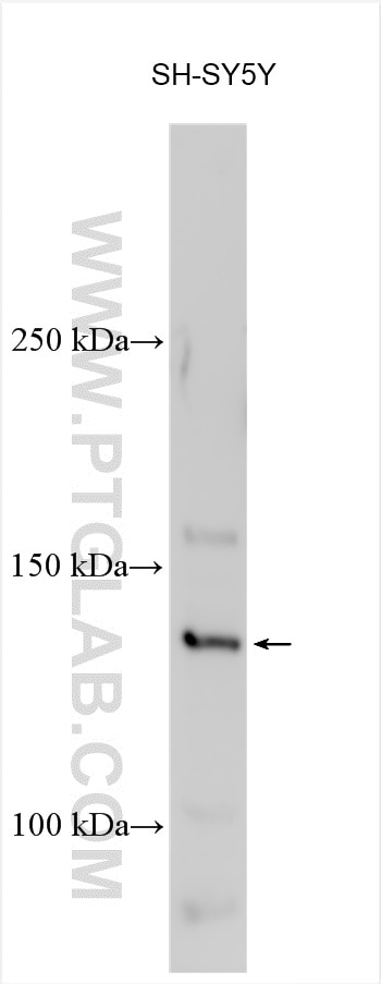 Western Blot (WB) analysis of various lysates using AFF2 Polyclonal antibody (25414-1-AP)