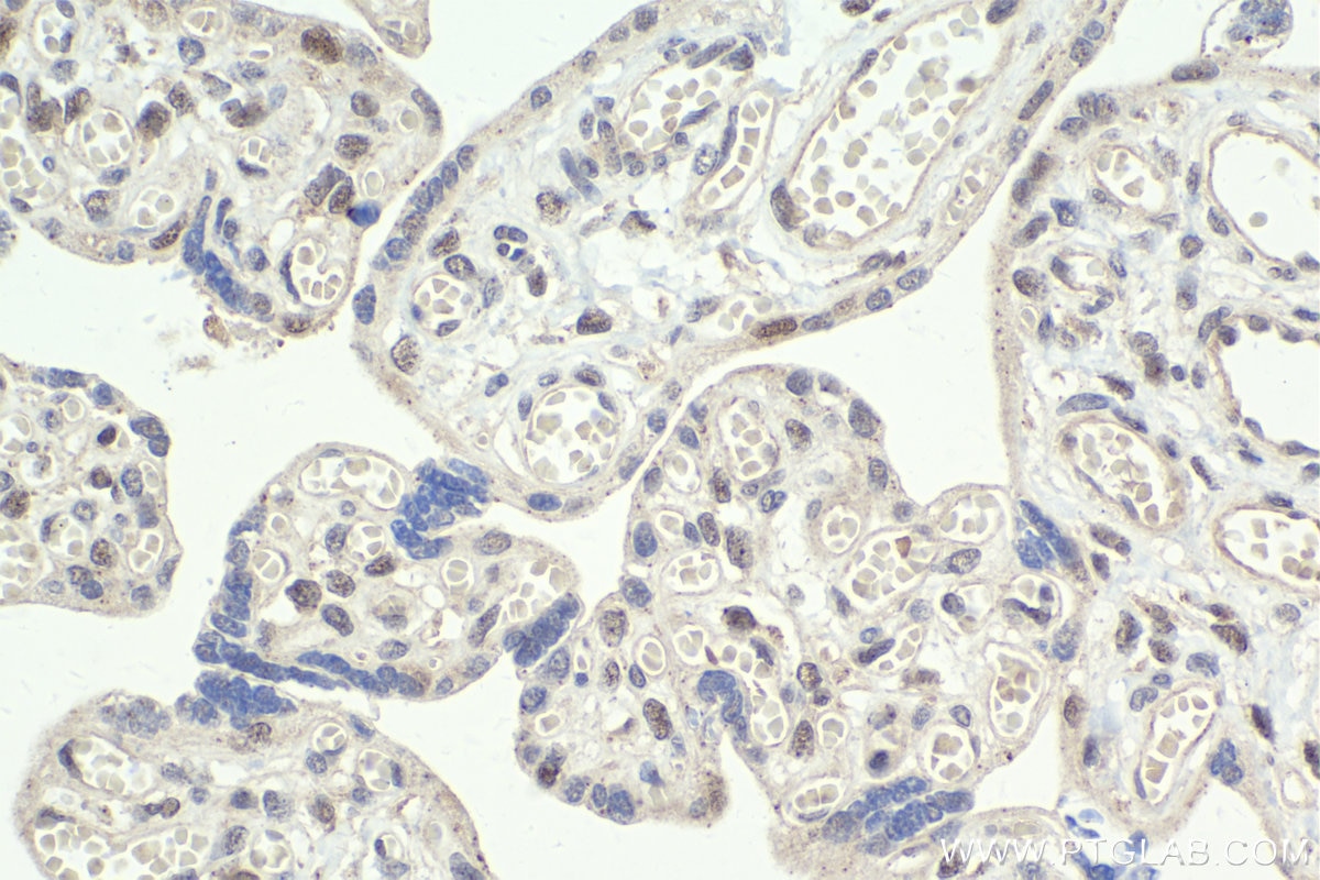 Immunohistochemistry (IHC) staining of human placenta tissue using AFF4 Polyclonal antibody (13197-1-AP)