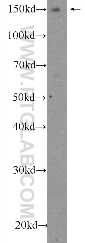 Western Blot (WB) analysis of Jurkat cells using AFF4 Polyclonal antibody (13197-1-AP)