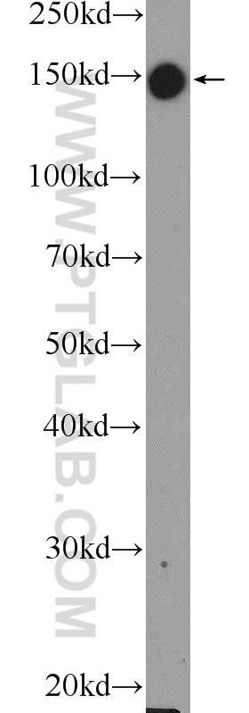 Western Blot (WB) analysis of HL-60 cells using AFF4 Polyclonal antibody (13197-1-AP)