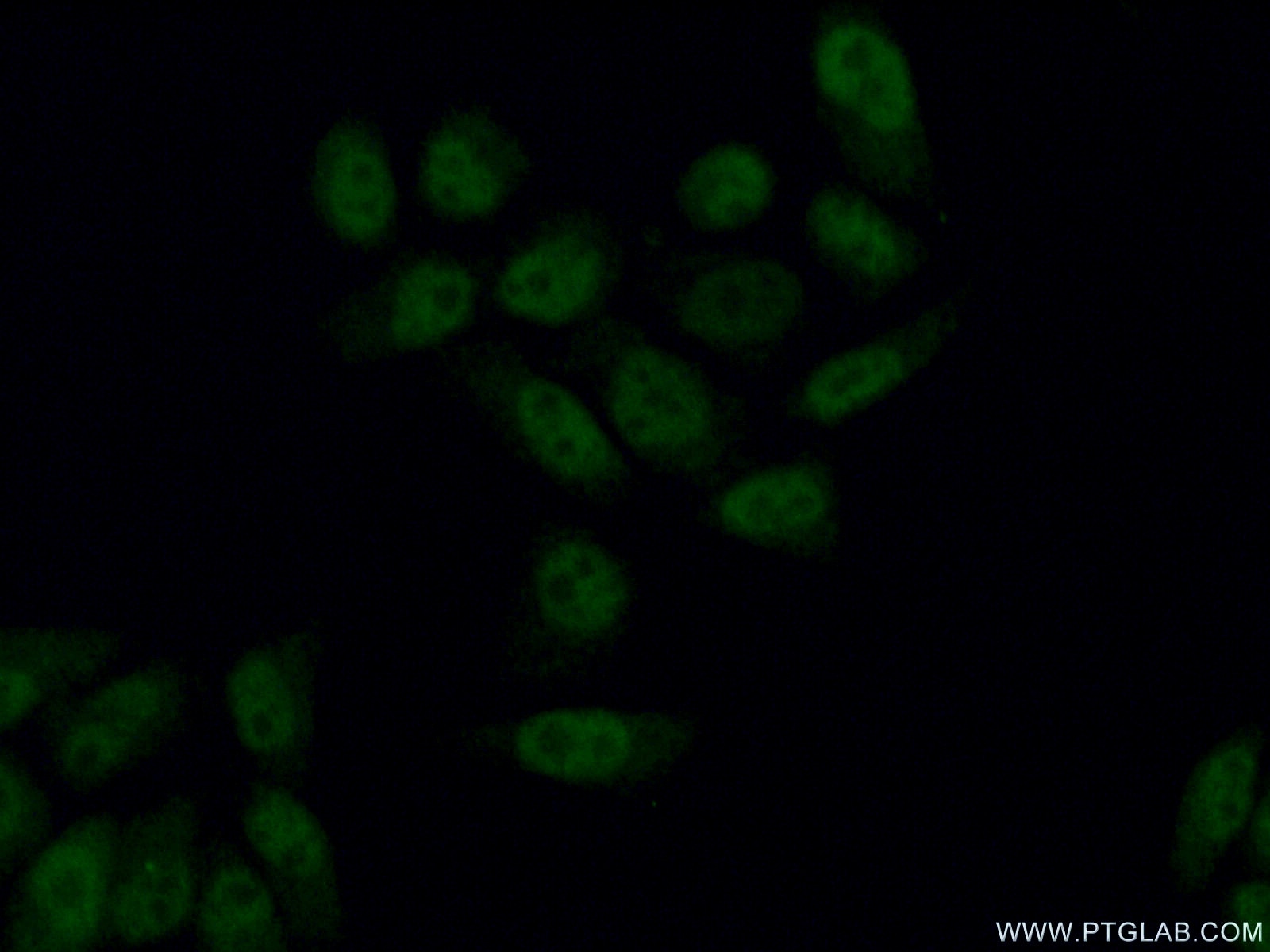 Immunofluorescence (IF) / fluorescent staining of L02 cells using AFF4 Polyclonal antibody (14662-1-AP)
