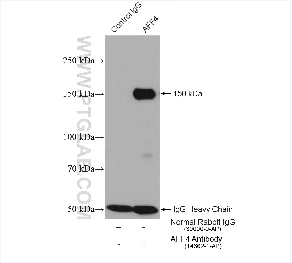 Immunoprecipitation (IP) experiment of HeLa cells using AFF4 Polyclonal antibody (14662-1-AP)