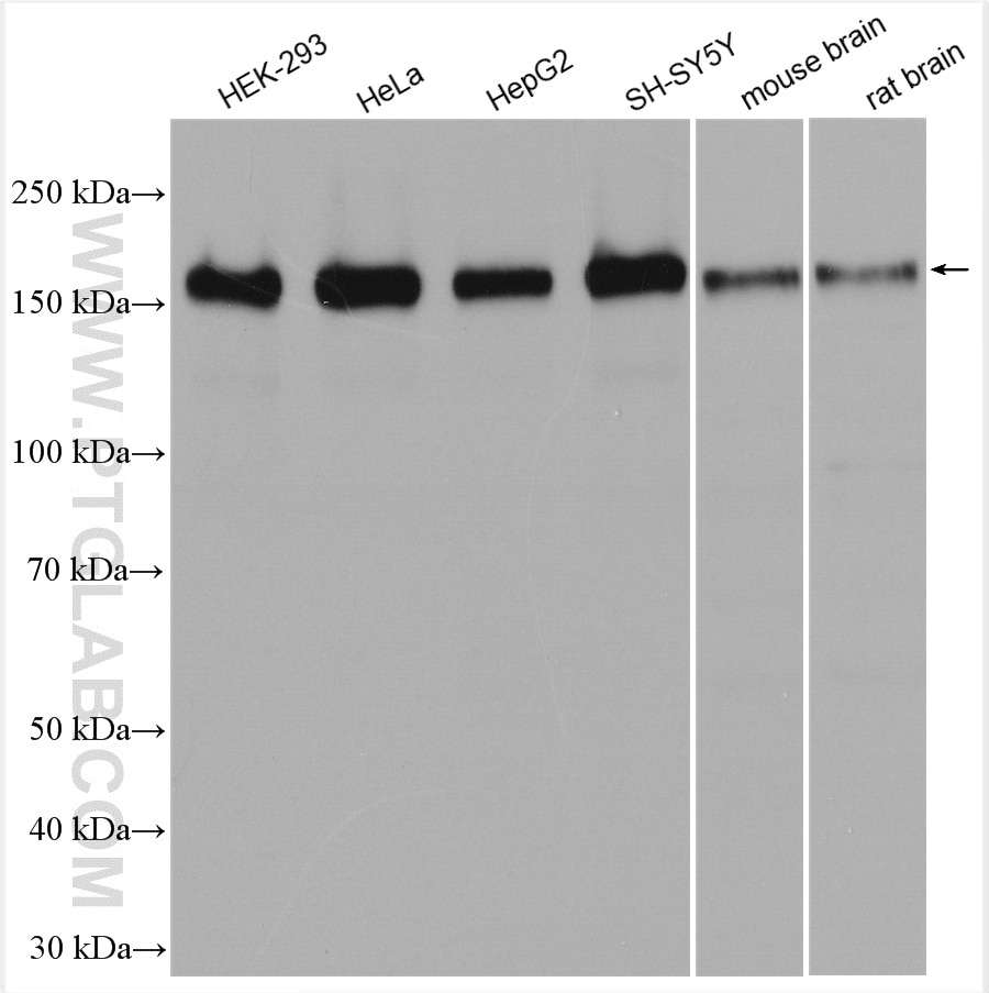 Western Blot (WB) analysis of various lysates using AFF4 Polyclonal antibody (14662-1-AP)