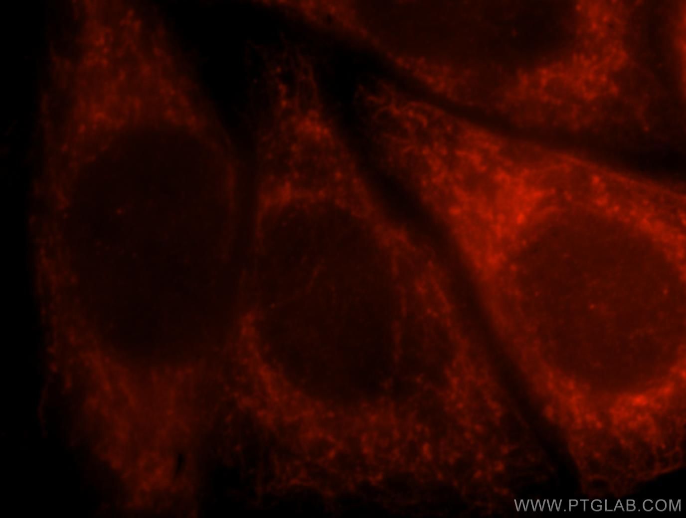 Immunofluorescence (IF) / fluorescent staining of HepG2 cells using AFG3L2 Polyclonal antibody (14631-1-AP)
