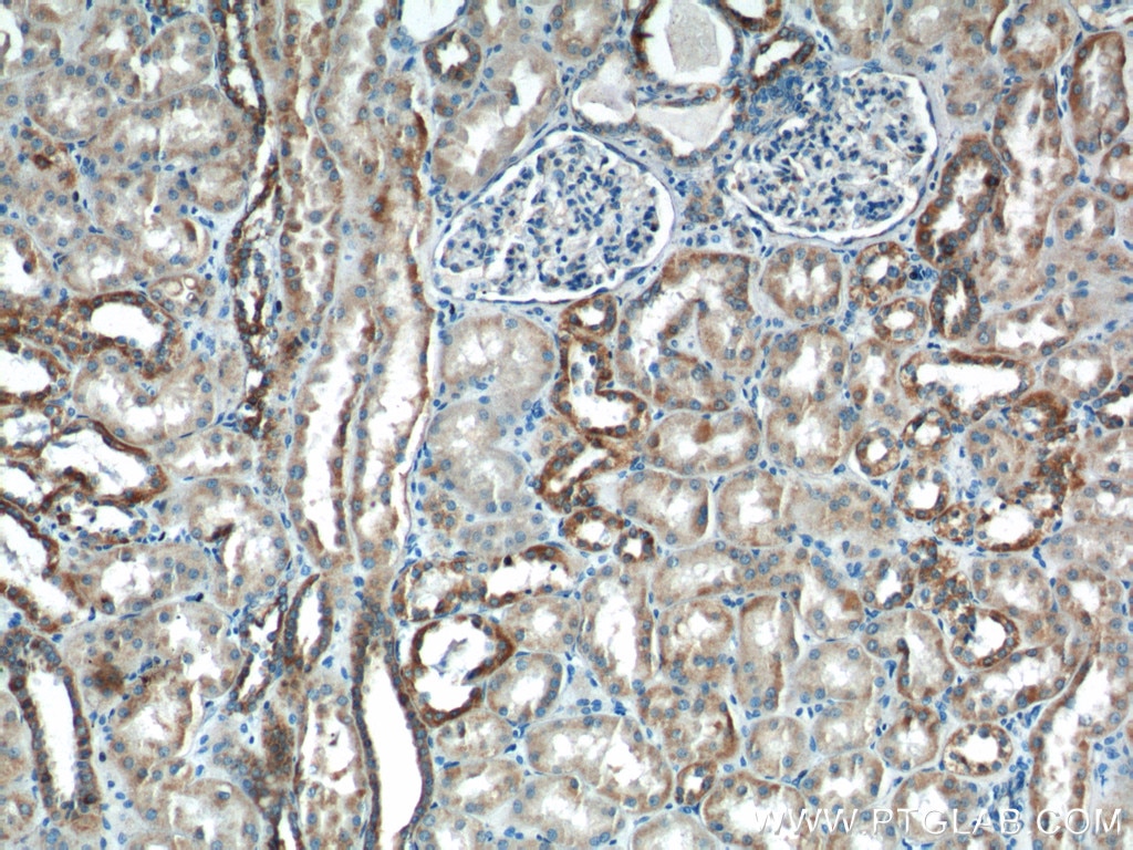 IHC staining of human kidney using 14631-1-AP