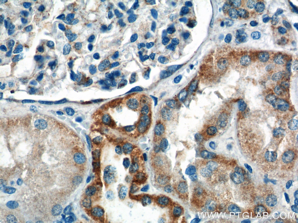 Immunohistochemistry (IHC) staining of human kidney tissue using AFG3L2 Polyclonal antibody (14631-1-AP)