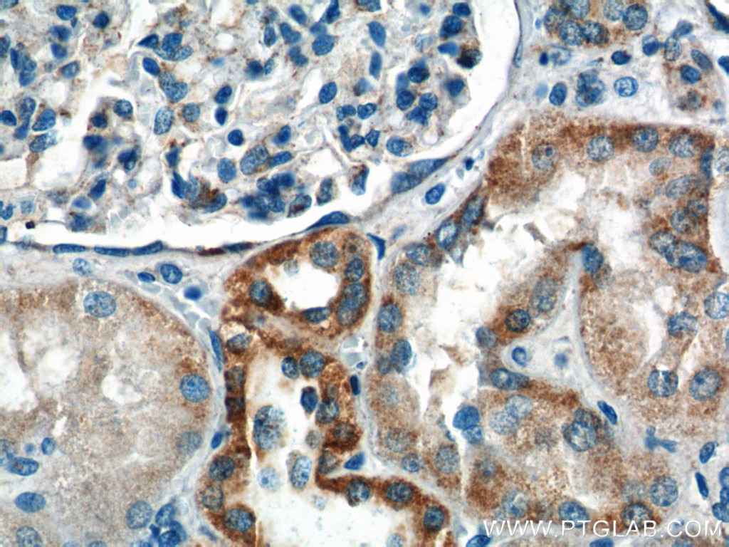 IHC staining of human kidney using 14631-1-AP