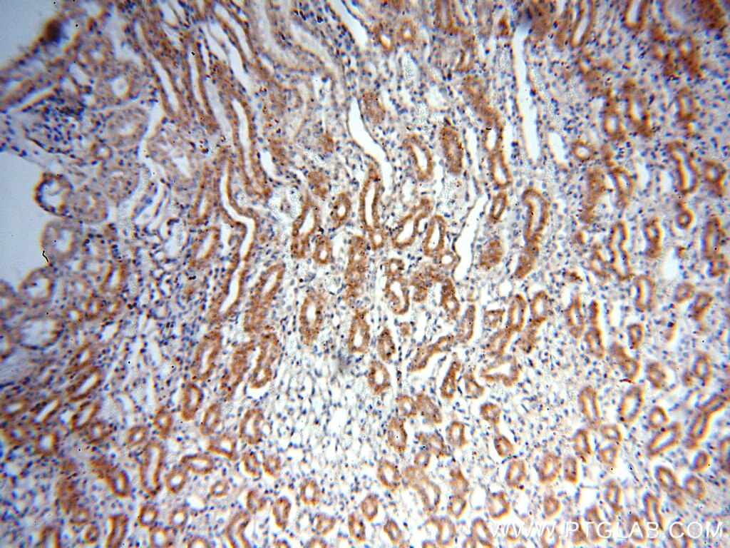 Immunohistochemistry (IHC) staining of human kidney tissue using AFG3L2 Polyclonal antibody (14631-1-AP)