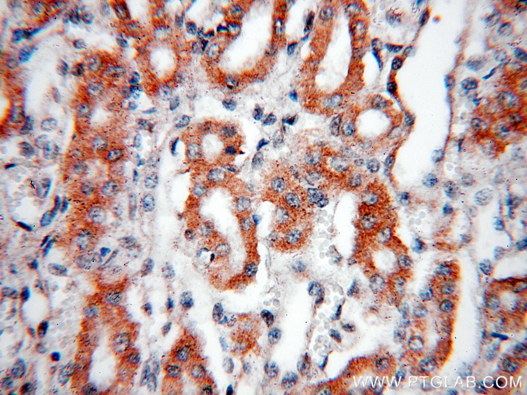 Immunohistochemistry (IHC) staining of human kidney tissue using AFG3L2 Polyclonal antibody (14631-1-AP)